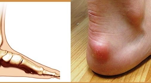 {{brizy_dc_image_alt entityId=