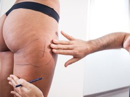 {{brizy_dc_image_alt entityId=