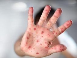 {{brizy_dc_image_alt entityId=