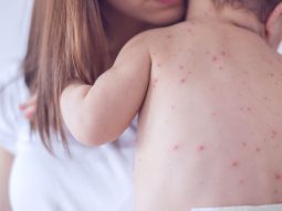 {{brizy_dc_image_alt entityId=