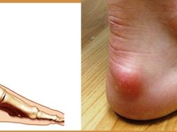 {{brizy_dc_image_alt entityId=