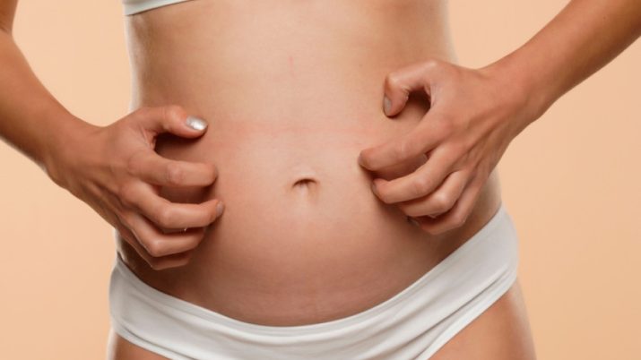 {{brizy_dc_image_alt entityId=