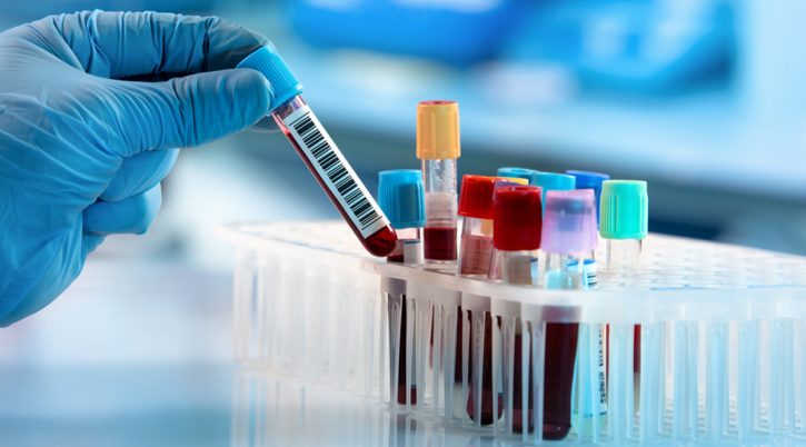 {{brizy_dc_image_alt entityId=