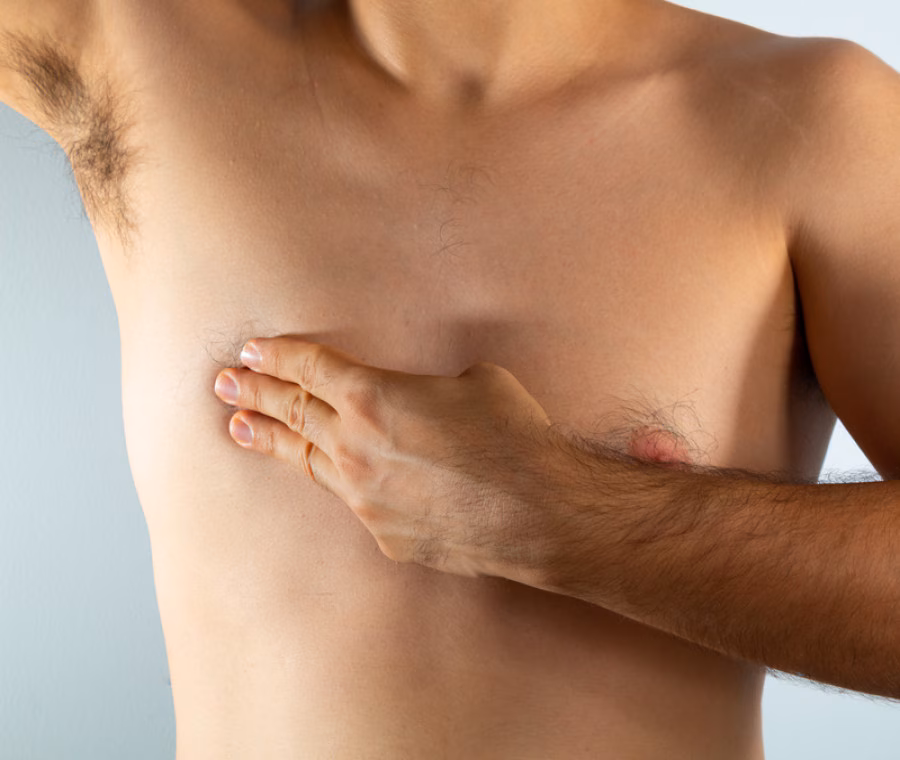 Tumore al seno maschile: cosa è e la necessità di un check-up accurato per gli uomini