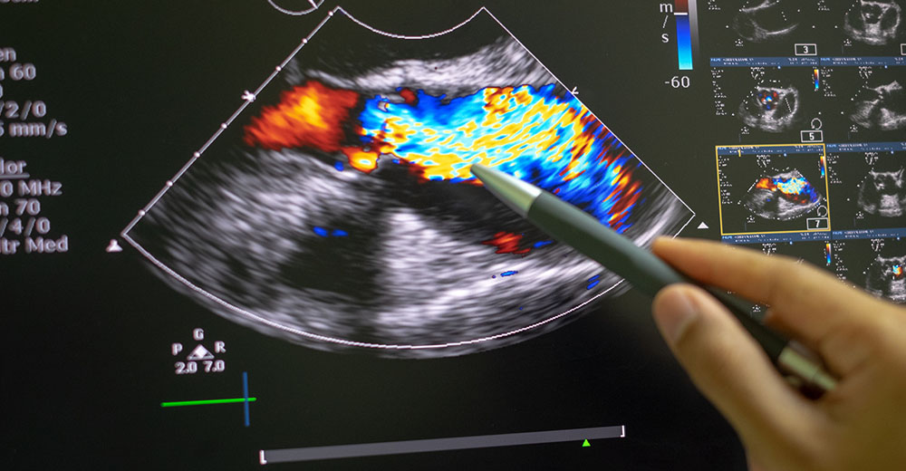 ecocardiogramma esami medical group italia