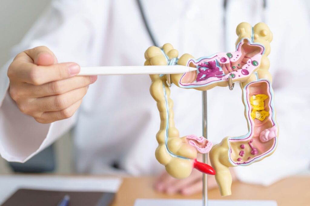 L'allarme mondiale sul cancro al colon retto cosiddetto giovanile