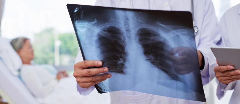 A cosa serve la visita pneumologica?