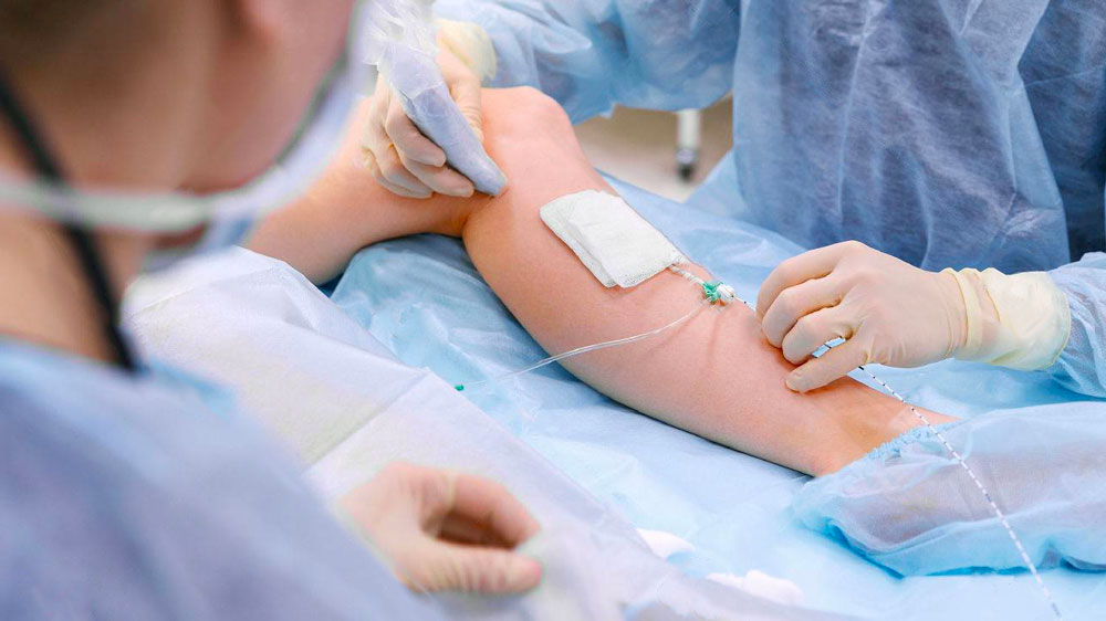 Chirurgia vascolare: tecniche sempre meno invasive