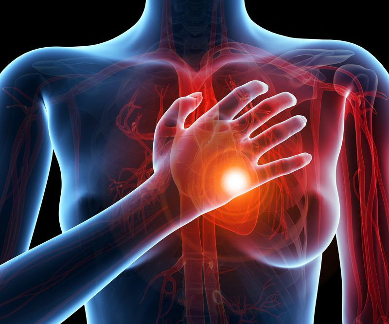 Bring-Up: un intervento nazionale su larga scala per le malattie cardiovascolari