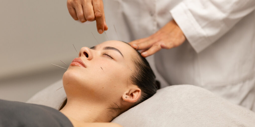 Origini e diffusione della neuro agopuntura