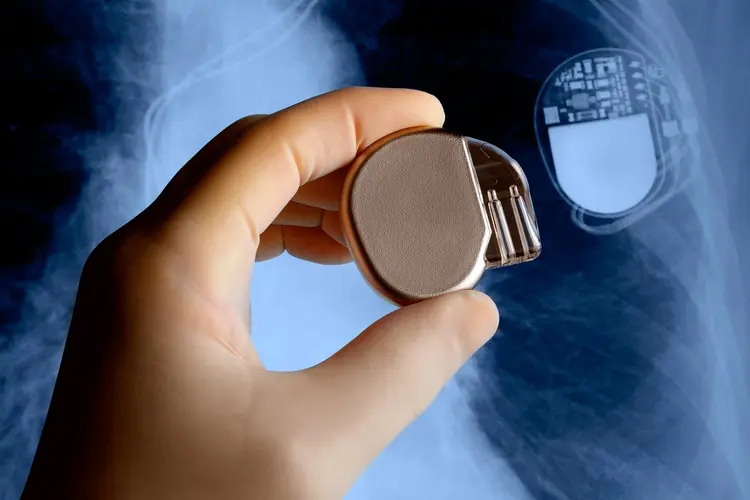 Pacemaker: un supporto per la qualità della vita