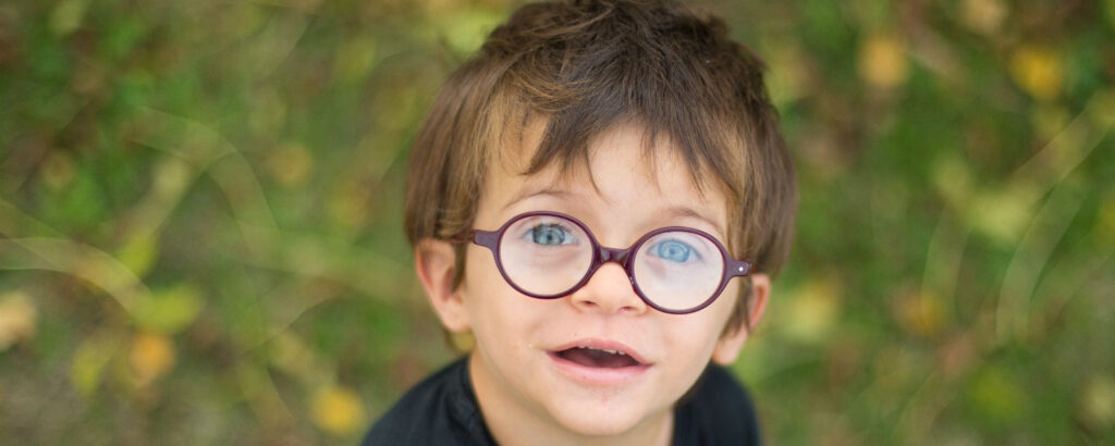 Sindrome di Noonan: ricoveri ospedalieri elevati nei primi mesi di vita