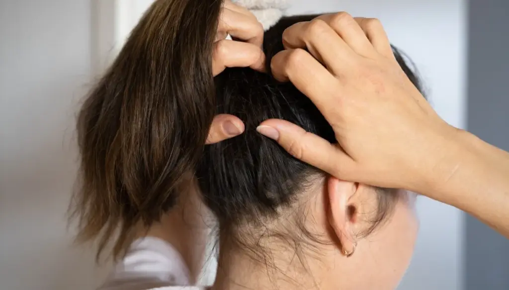 Cause e fattori che influenzano la dermatite seborroica del cuoio capelluto