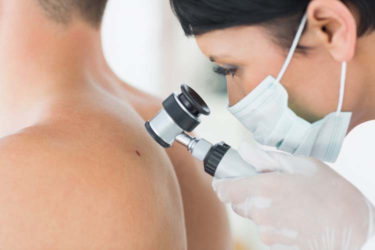 Visite specialistiche mirate e prevenzione integrata: la glicemia elevata potrebbe compromettere le cure del melanoma