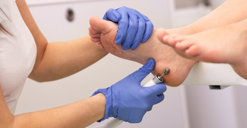 Il podologo nello sport: prevenzione, diagnosi e performance