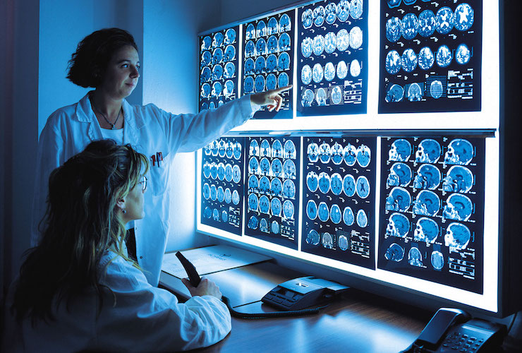 Diagnostica del futuro per studio precoce delle attività cerebrali