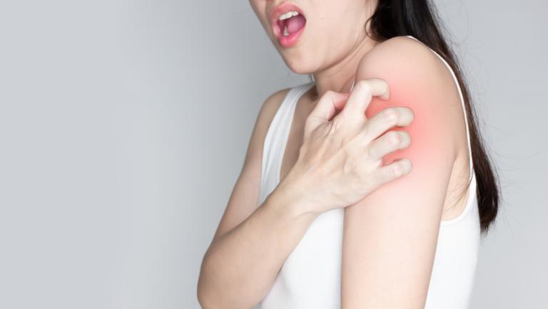 Visite specialistiche e prevenzione: parola d'ordine diagnosi precoce per curare la scabbia