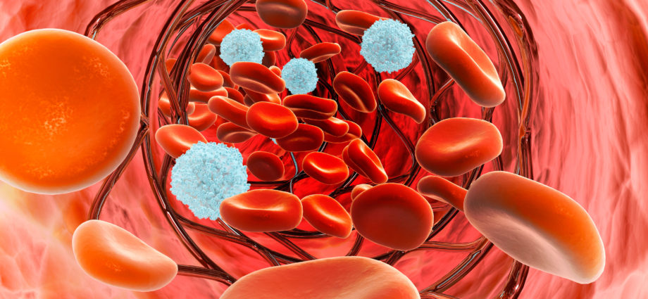 Prevenzione ed esami diagnostici per individuare e combattere la mielofibrosi