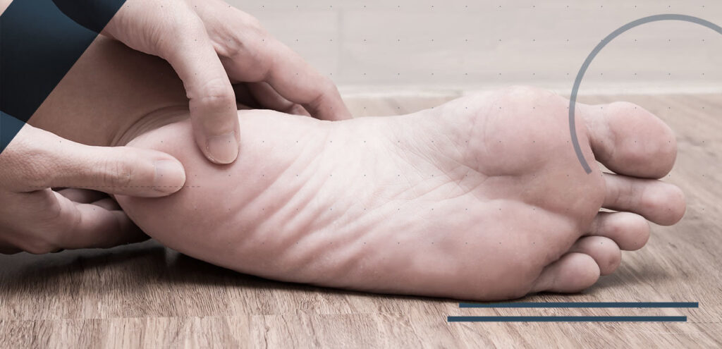 Fascite plantare: visite specialistiche e prevenzione