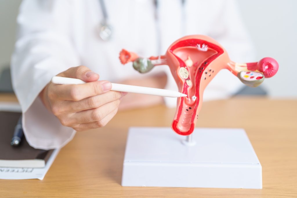 Perché il cancro cervicale colpisce donne giovani e anche donne mature