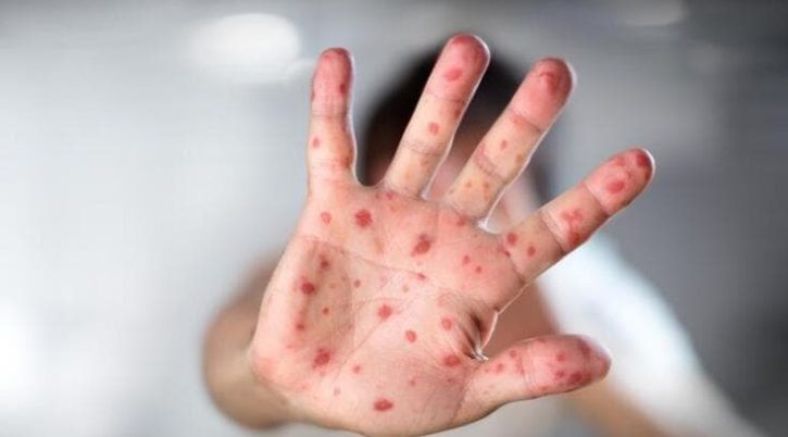 {{brizy_dc_image_alt entityId=