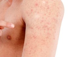 {{brizy_dc_image_alt entityId=