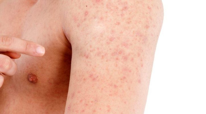 {{brizy_dc_image_alt entityId=