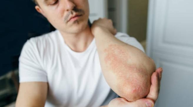 {{brizy_dc_image_alt entityId=