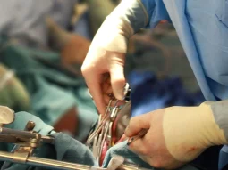 {{brizy_dc_image_alt entityId=