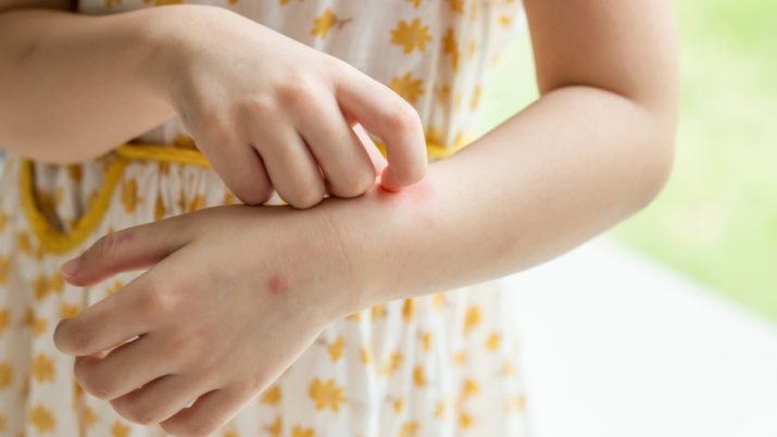 {{brizy_dc_image_alt entityId=