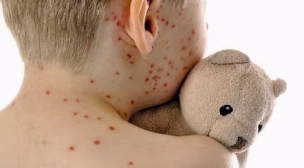 {{brizy_dc_image_alt entityId=