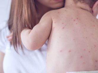 {{brizy_dc_image_alt entityId=