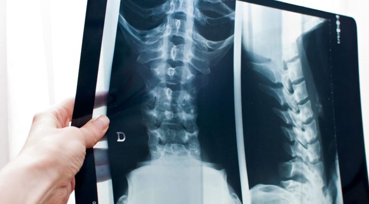 {{brizy_dc_image_alt entityId=