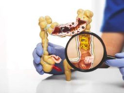 {{brizy_dc_image_alt entityId=